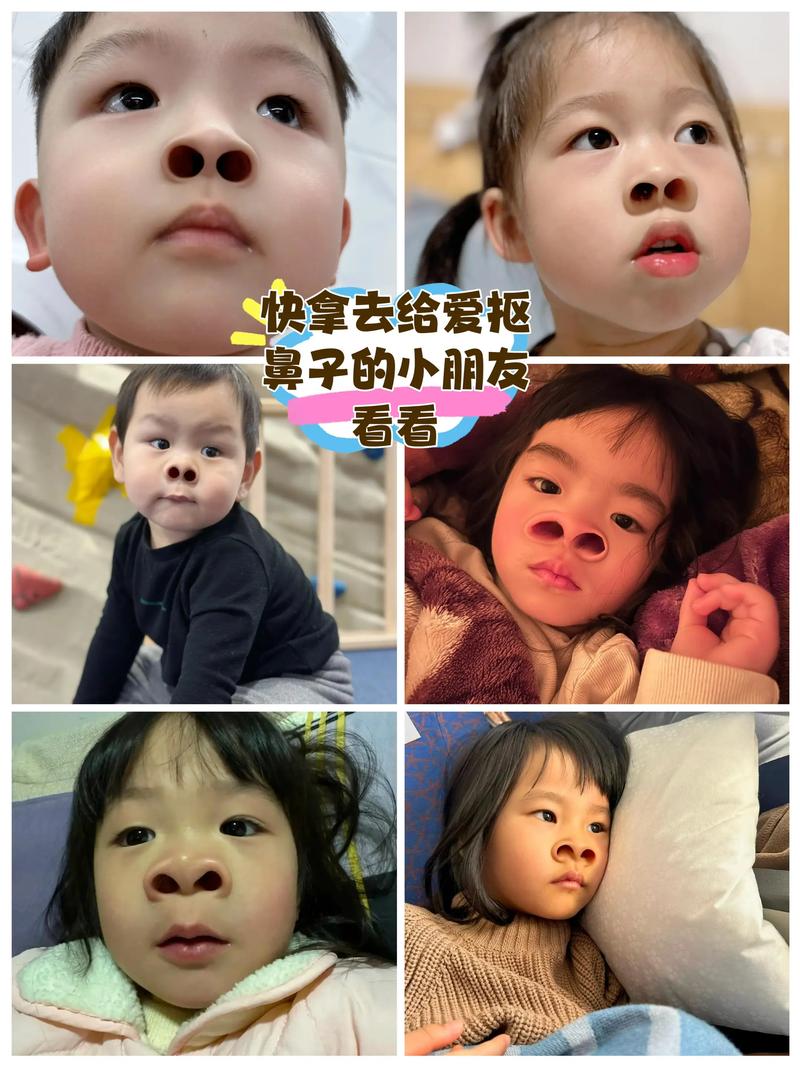 2025天天开彩资料大全免费下载安装和挖鼻孔满脸肿胀变形与挖鼻孔满脸肿胀变形怎么办